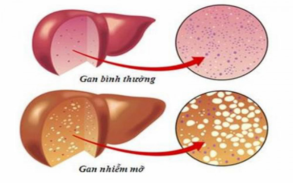 giảm cân tự nhiên